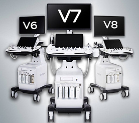 Искусственный интеллект для точной диагностики – теперь в Samsung V6, V7 и V8!