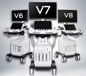 Aniq diagnostika uchun sun'iy intellekt – endi Samsung V6, V7 va V8 da!